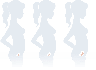 stage1
