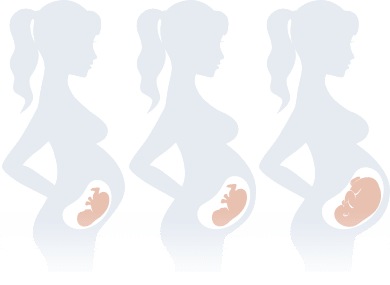 stage3